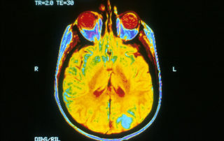 Credits: National Cancer Institute